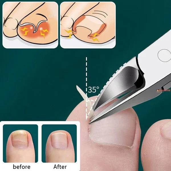 (🎁2024 New Year Hot Sale🎁)🔥 49% OFF🔥Professional Nail Clipper